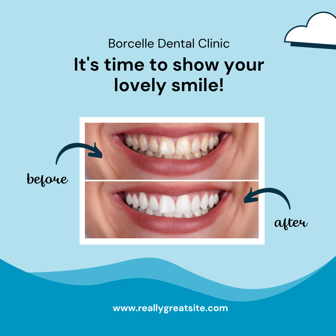 Dental Template