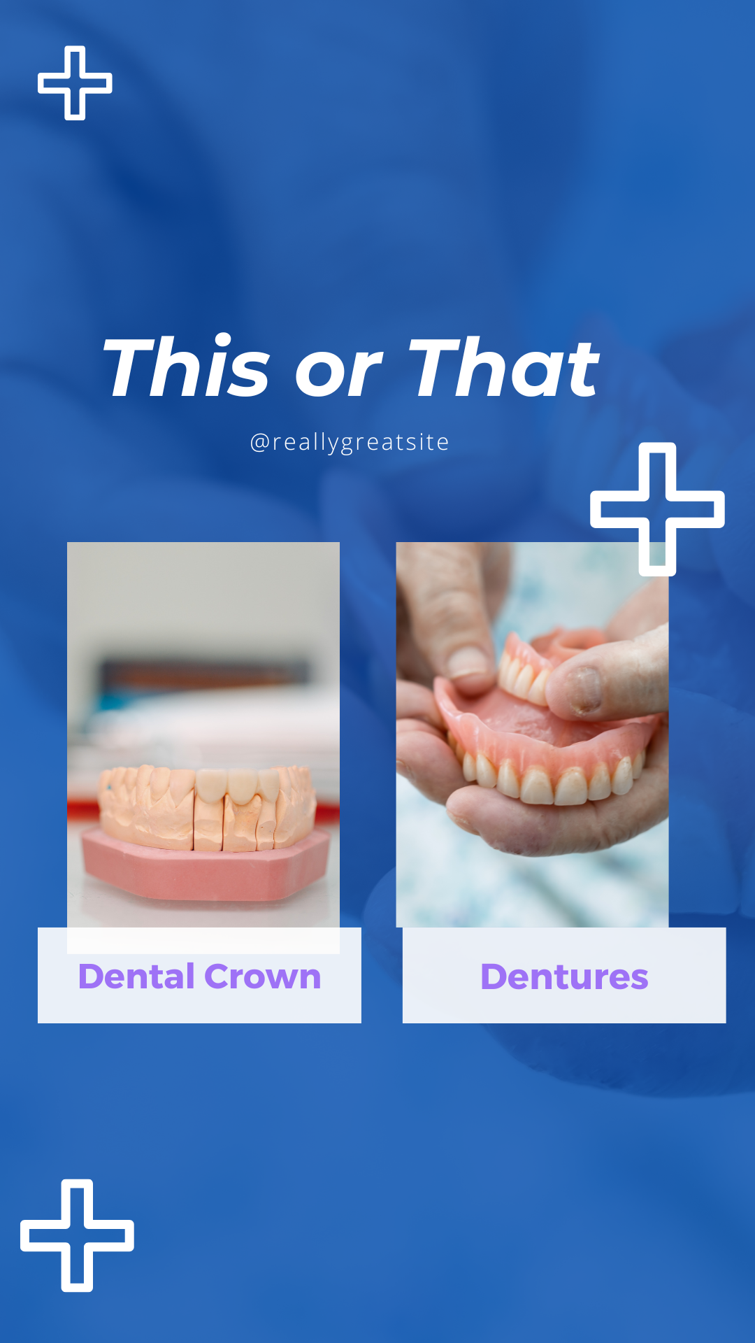 Dental template example